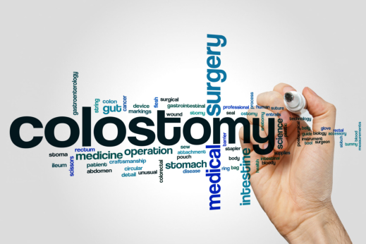 Parents’ Guide to Caring for Children with a Colostomy